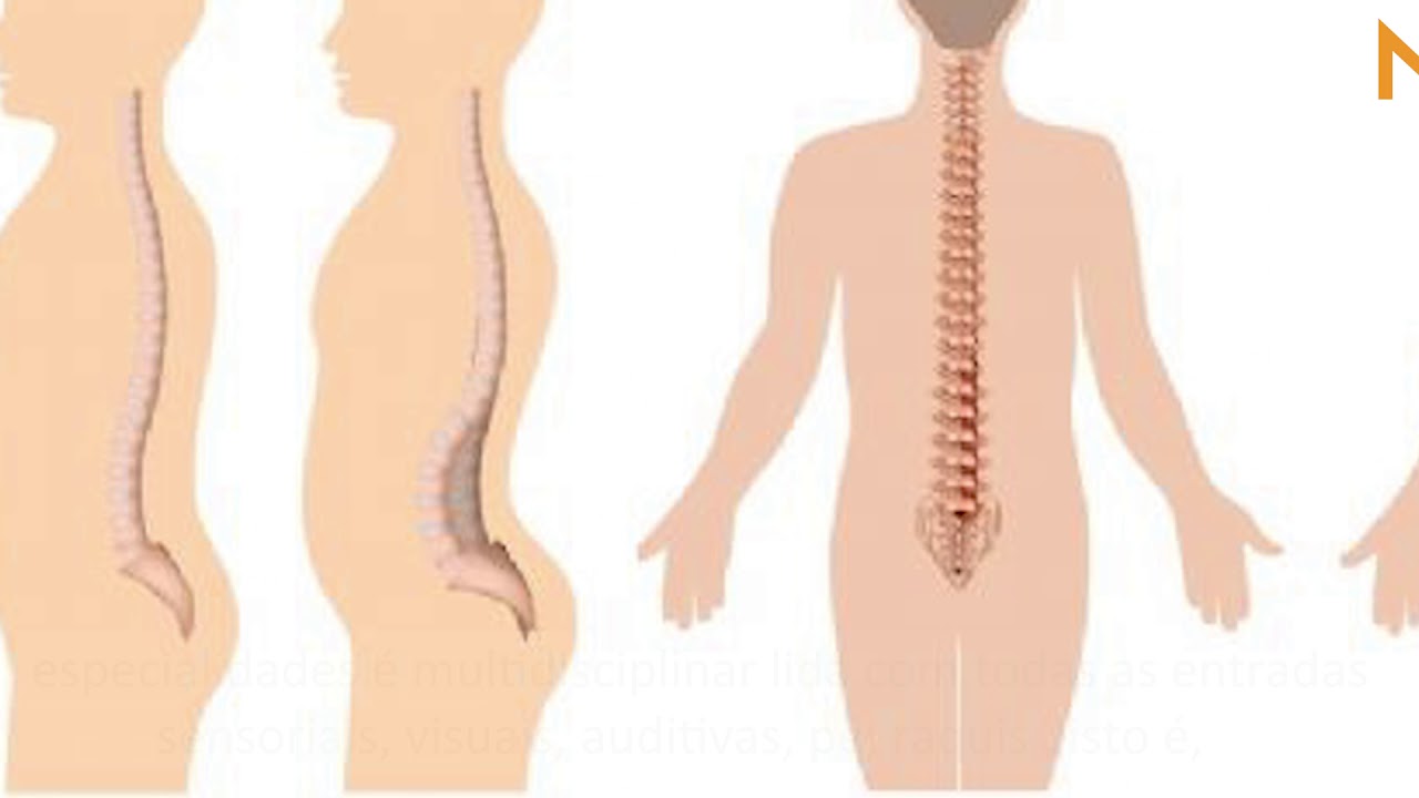 Posturologia – Exame Clínico do Sistema Tónico Postural e do Equilíbrio | Why Motion
