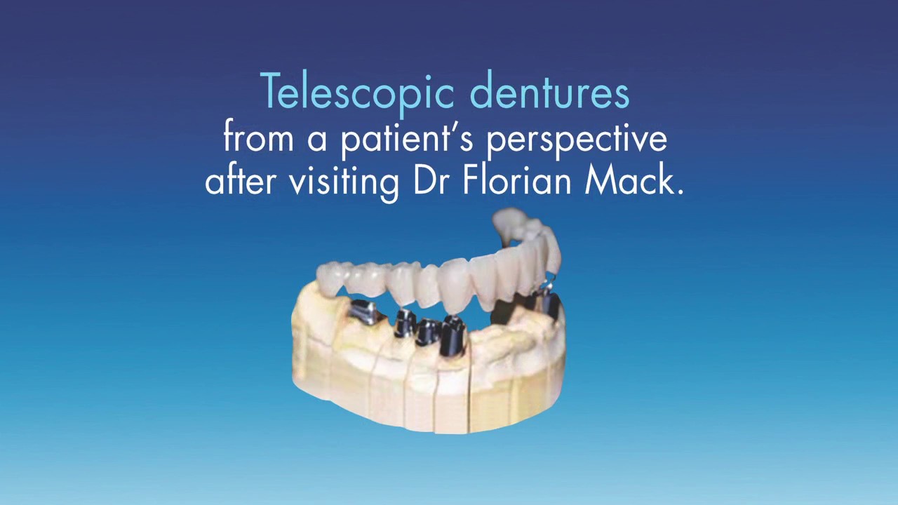 Telescopic Dentures by Dr Florian Mack