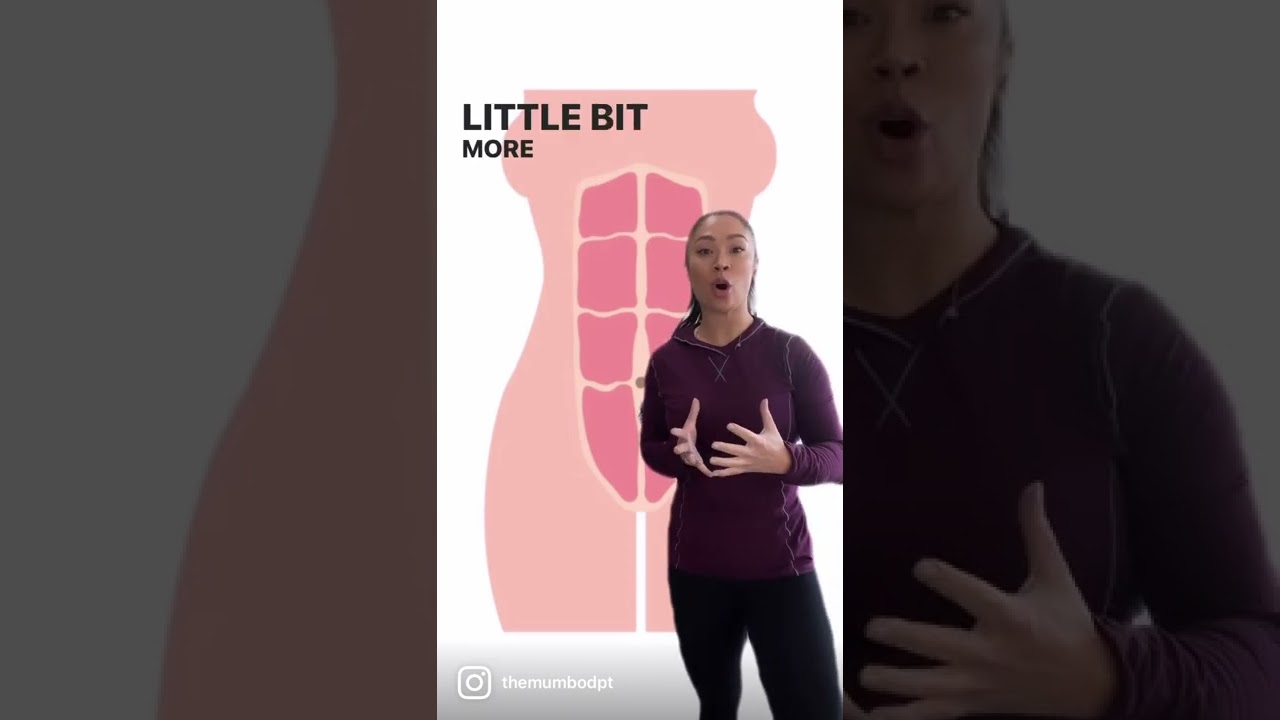 Here’s Why Diastasis Recti Is Not A One Size Fits All Approach!
