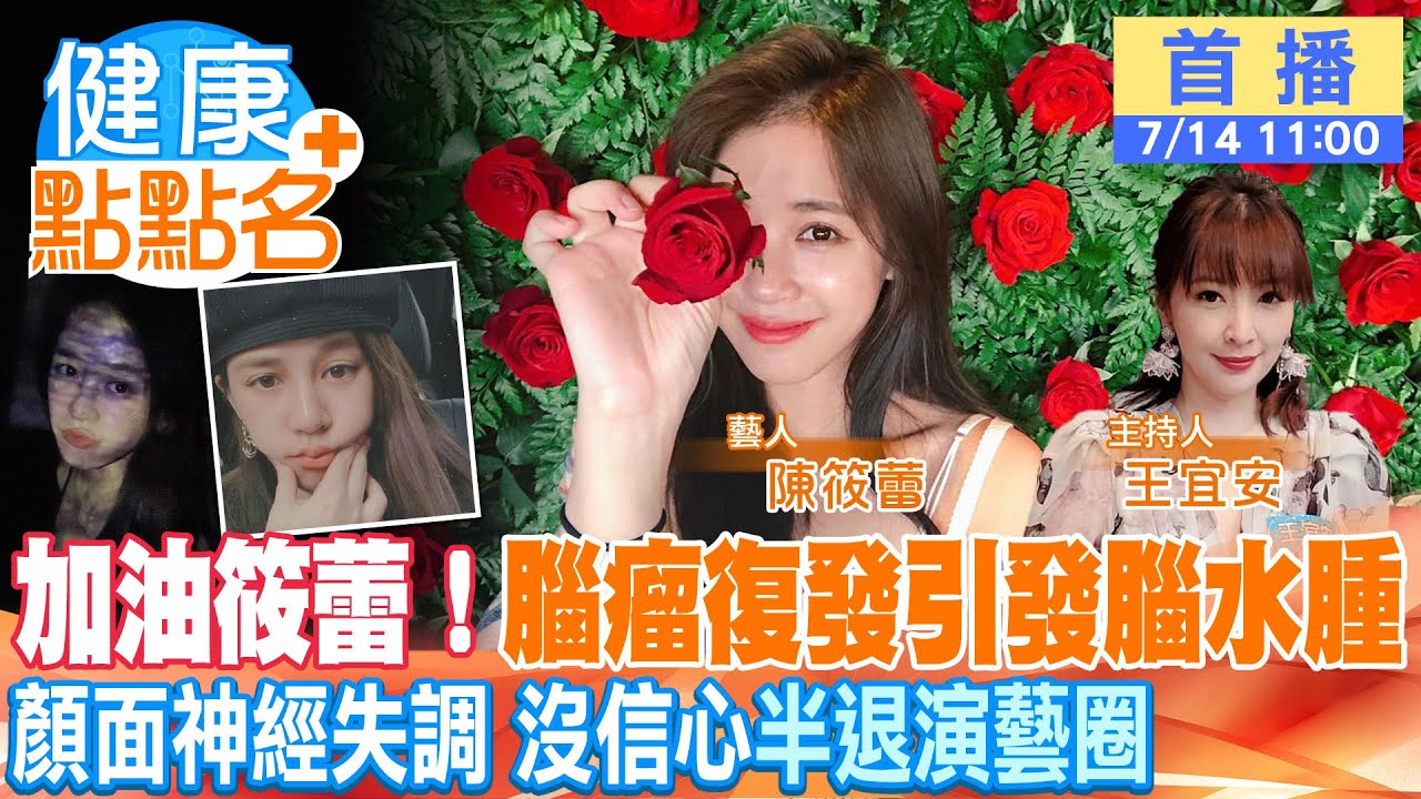 【健康點點名】崩潰！腦瘤再復發，放射線燒腦竟聞燒焦味！陳筱蕾面癱臉歪，不敢上節目！ @健康我加1CtiHealthyme  @中天電視CtiTv