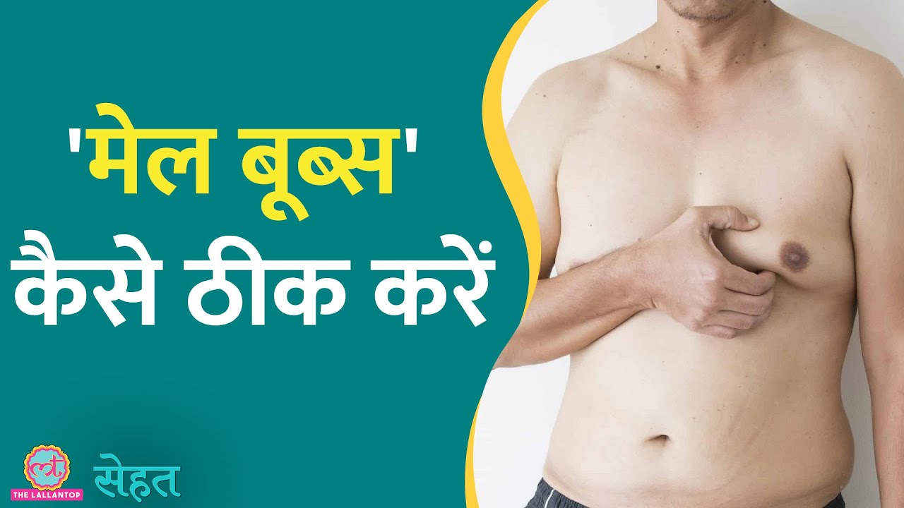 Gynecomastia यानी पुरुषों के स्तन क्यों निकल आते हैं? | Male Boobs| Sehat ep 500