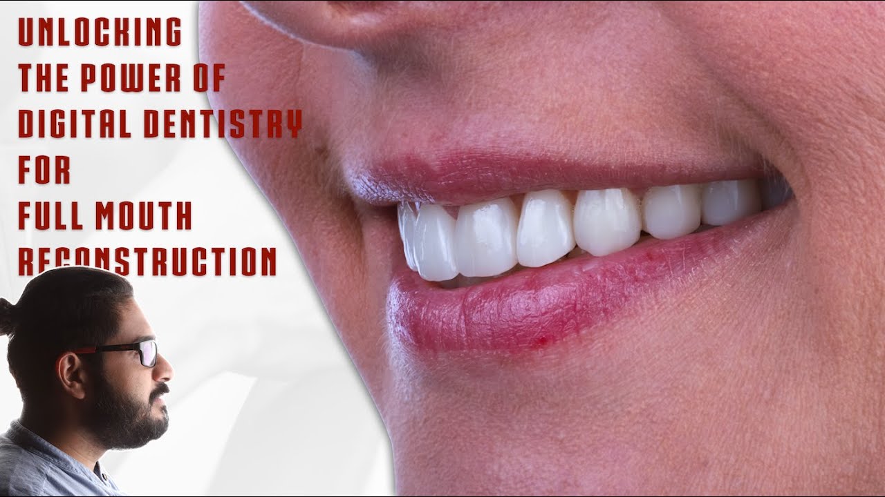 Unlocking the Power of Digital Dentistry for Full Mouth Reconstruction I Why use Digital Protocols