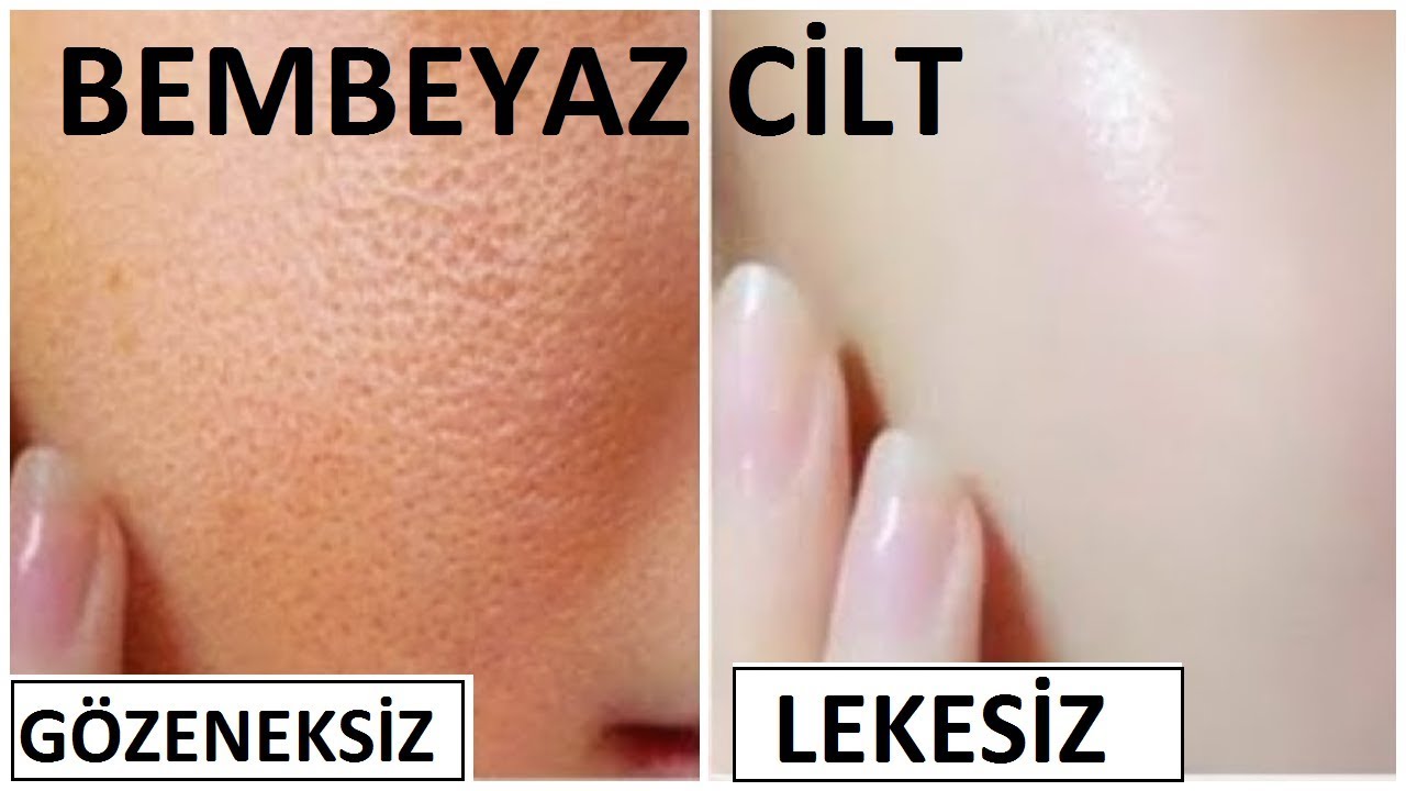 ANINDA CİLT BEYAZLATMA - LEKE GİDERİCİ G&Ouml;ZENEK SIKILAŞTIRICI MASKE - G&Uuml;ZELLİK BAKIM