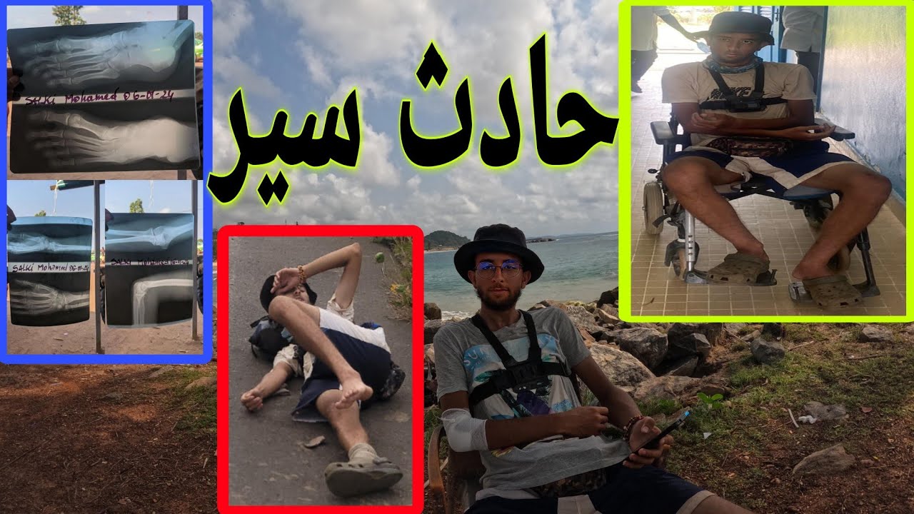 V63:🇨🇮 صدمتني سيارة 😱في الطريق إلى مدينة سان بيدرو