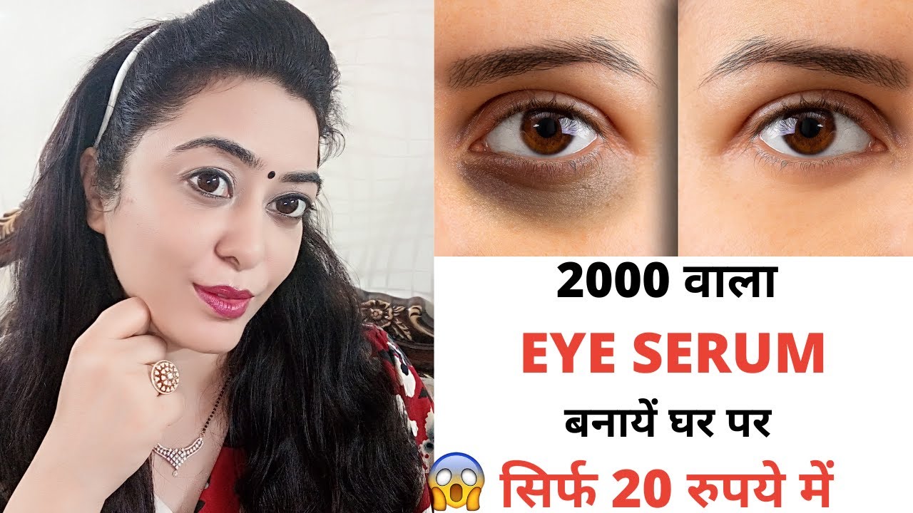 सिर्फ 1 रात मे आपके आंखों के काले घेरे झुर्रियाँ गायब कर देगा/Remove Undereye Dark Circles Instantly