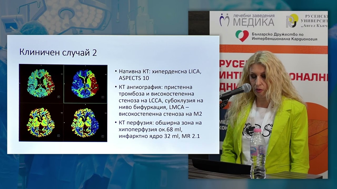 11. Новости в лечението на ИМИ и представяне на клинични случаи