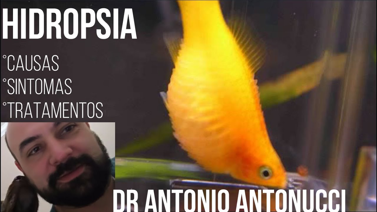 Como tratar a Hidropsia com Professor Antonio Antonucci Pt1/2