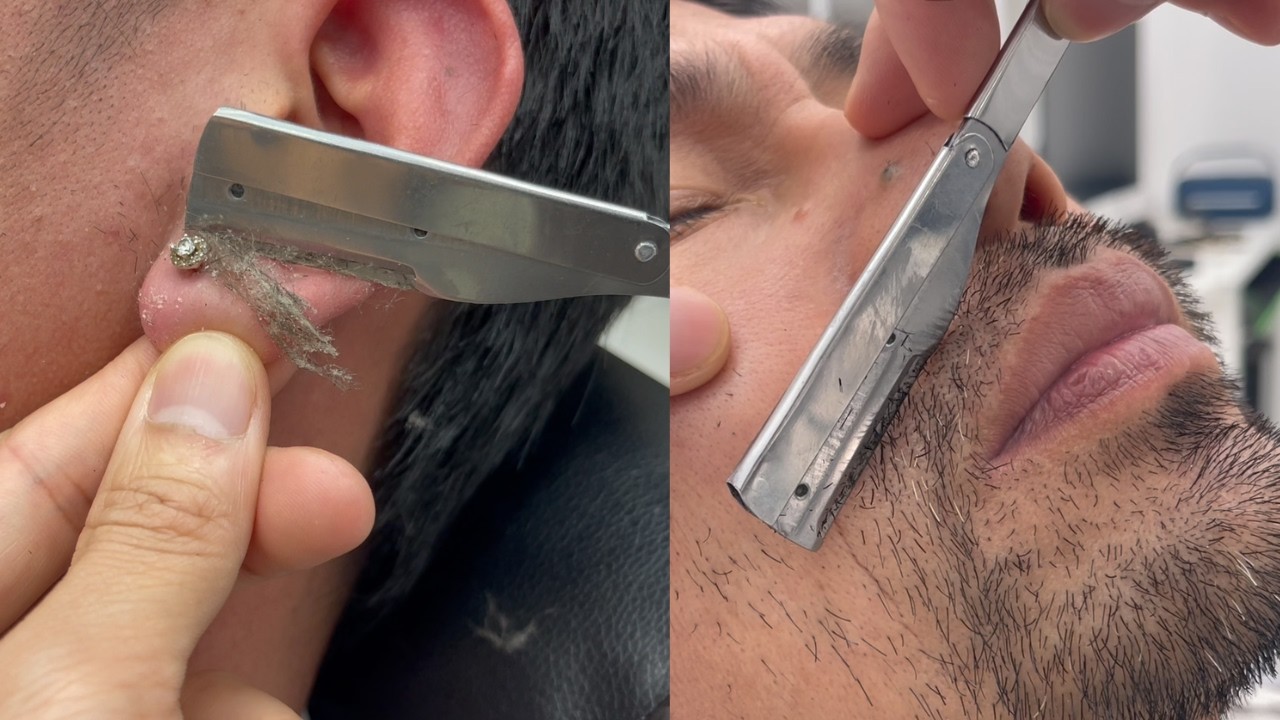 ASMR 🐤 FOR A GOOD SLEEP | REMOVES A LOT OF FINE HAIRS AND DEAD SKIN CELLS FROM THE FACE EP608.1