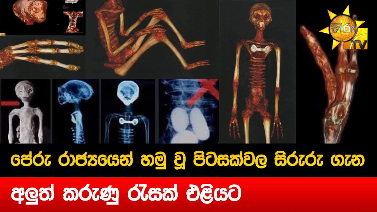 පිටසක්වල ජීවීන් ගැන ලෝකය හොල්ලන විද්‍යාත්මක සාක්ෂියක් - මිනිස් ජානවලට වඩා වෙනස් - Hiru News