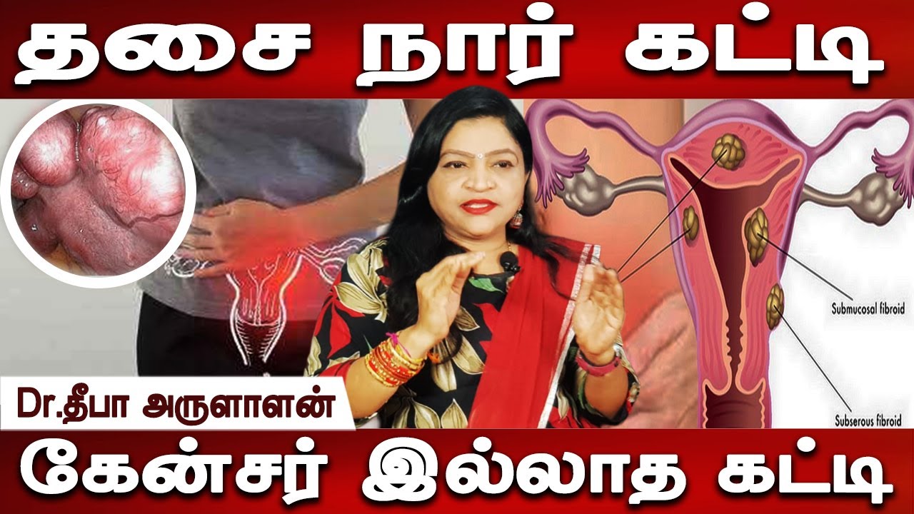 கர்ப்பப்பையை காப்பாற்றிக் கொள்ளுங்கள் | Fibroid Uterus | கருப்பை கட்டிகள் | Dr.Deepa Arulaalan