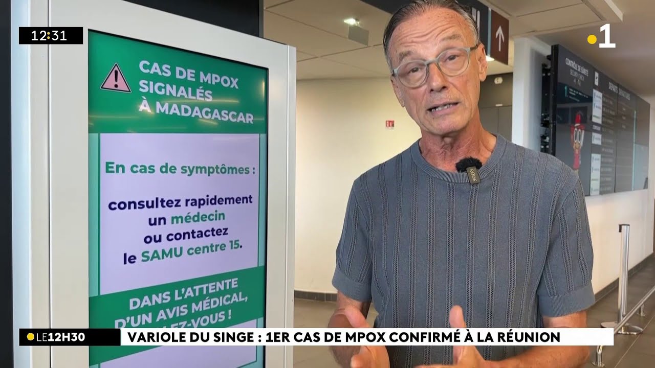 Apparition du premier cas de variole du singe à La Réunion, les autorités renforcent la prévention