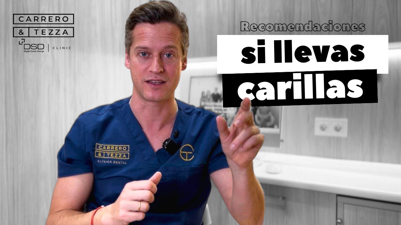 Recomendaciones Carillas