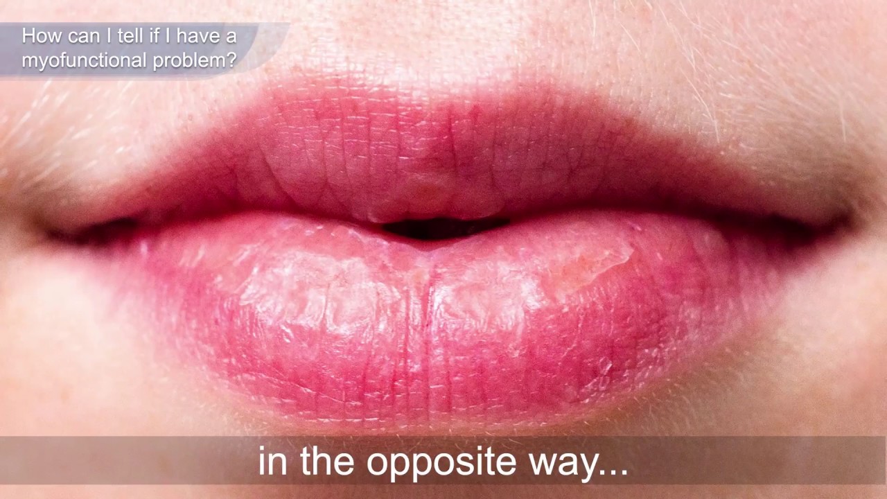 Myofunctional Therapy for Teens and Adults: TMJ Treatment