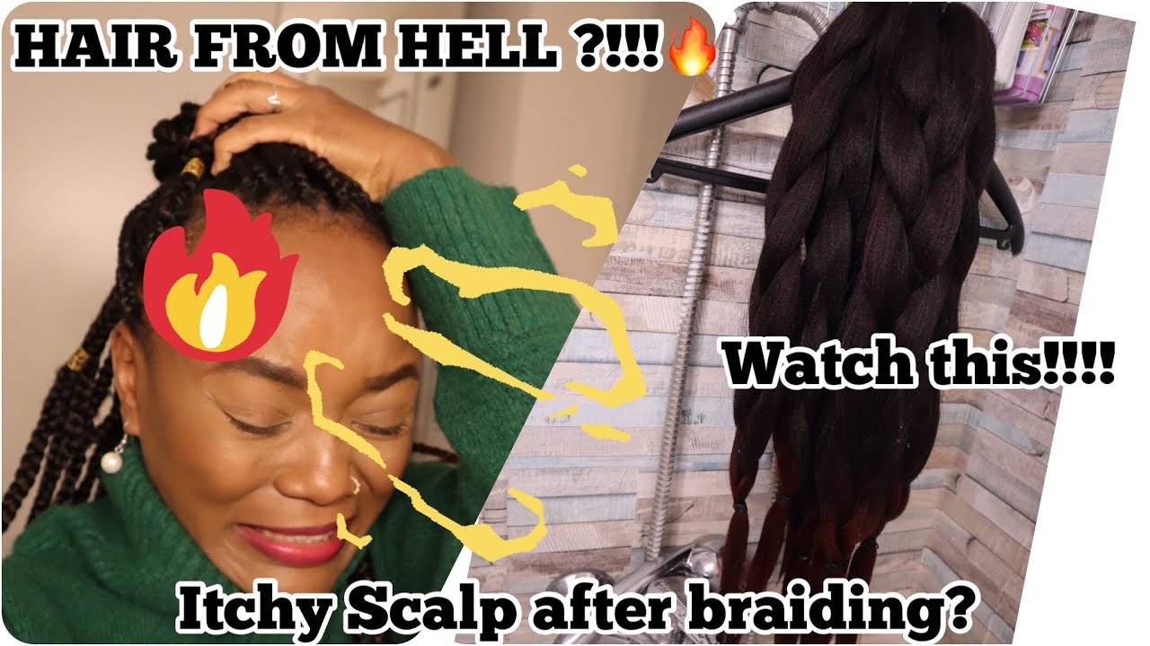 HOW TO STOP ITCHY SCALP AFTER BRAIDING / SYNTHETIC HAIR ALLERGY /ACV HAIR RINSE