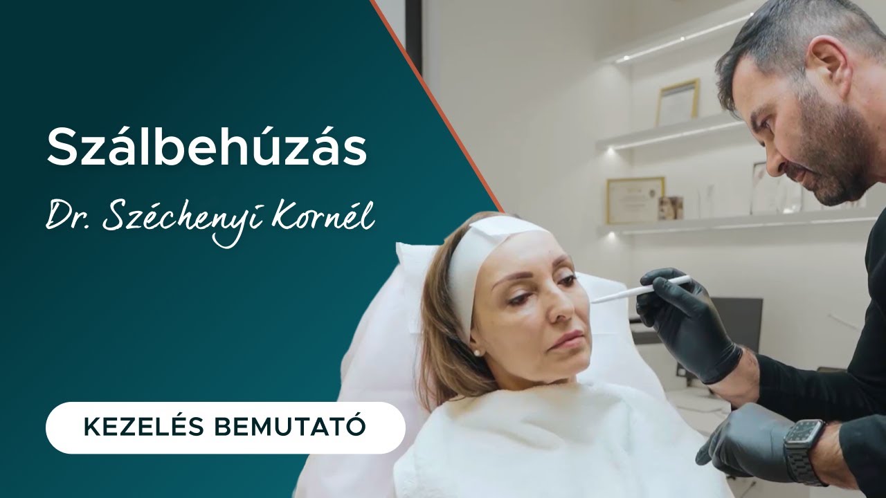 Bioszálas arclifting  Dr. Széchenyi Kornéllal
