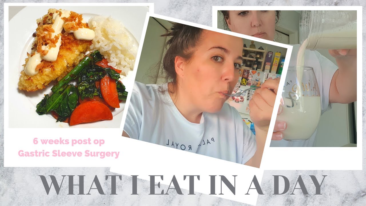 What I eat in a day | 6 weeks Post Gastric Sleeve Surgery