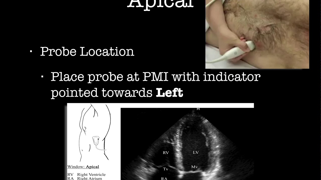 Intro to Cardiac US Windows