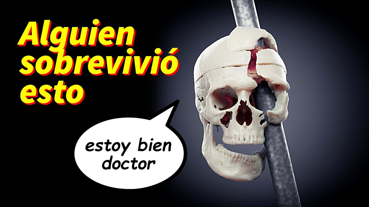 ALGUIEN SOBREVIVIÓ ESTO
