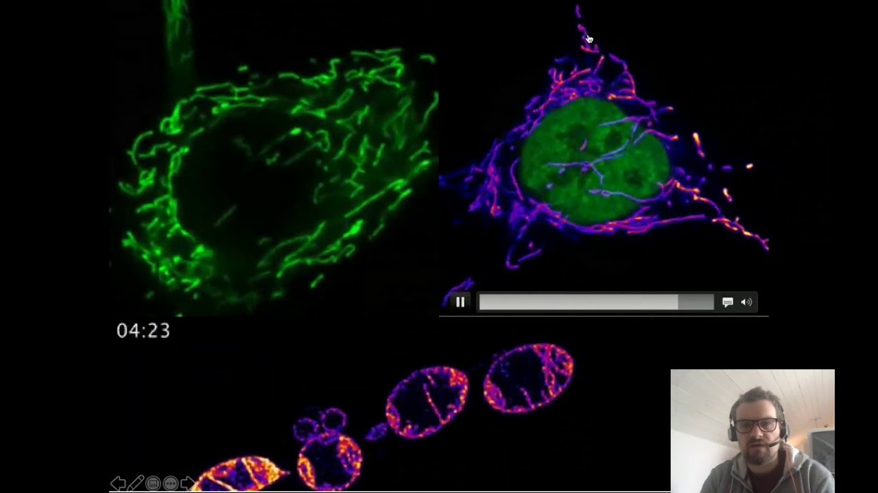 Lecture 1 -TCD Immunometabolism lecture series
