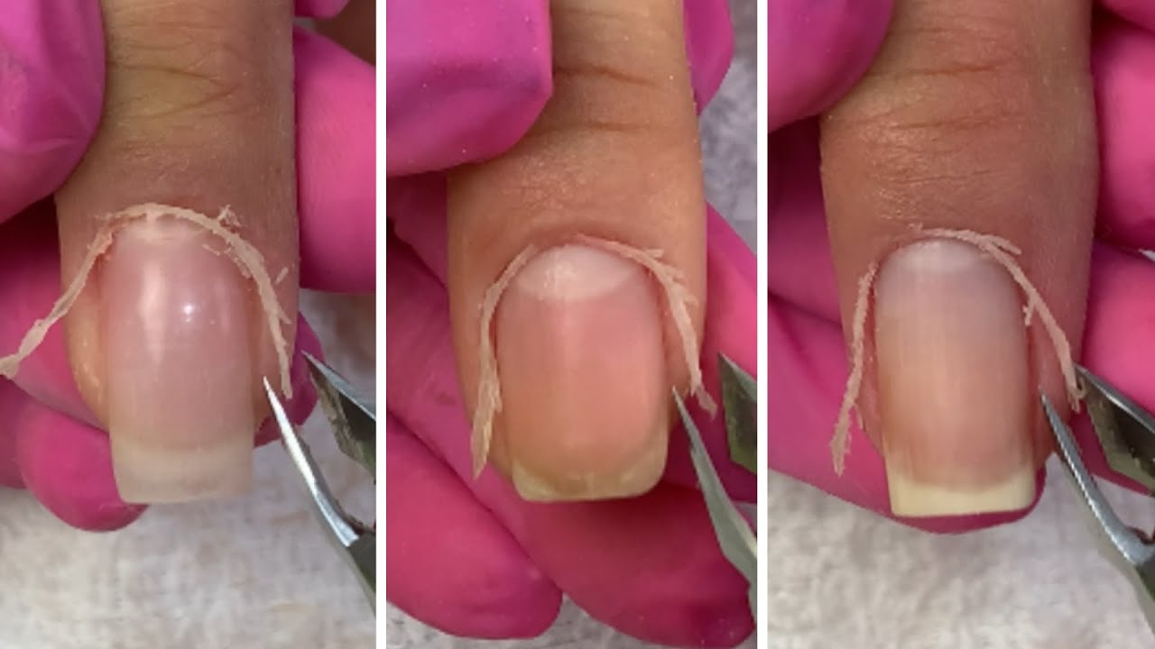 Removendo Cutículas das Mãos!! Perfeito.