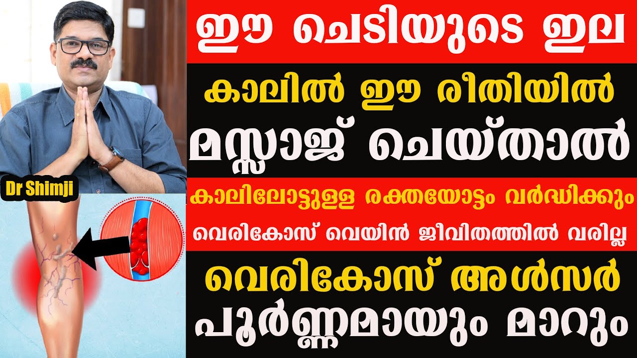 കാലിലെ രക്തയോട്ടം വർധിക്കാനും വെരികോസ് വരാതിരിക്കാനും വെരിക്കോസ്സ് അൾസർ പാടുപോലും  ഇല്ലാതെ മാറാനും