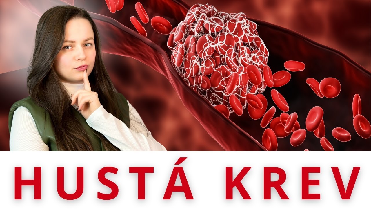 HUST&Aacute; KREV / 2 produkty, kter&eacute; pomohou ZŘEDIT KREV a m&aacute; je doma každ&yacute;