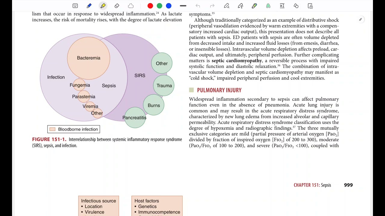 Sepsis and empirical antibiotics