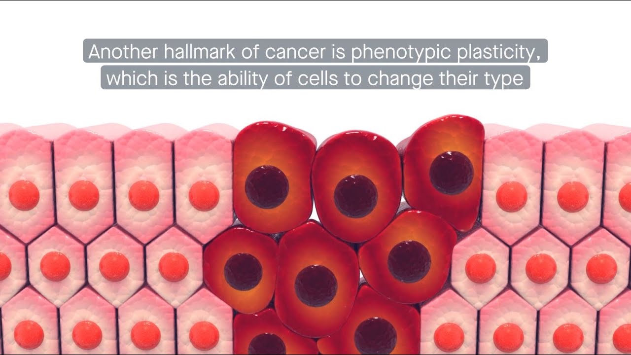 NF-κB signaling at the crossroads between chronic inflammation and cancer