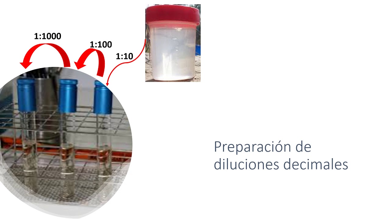 CUANTIFICACI&Oacute;N DE BACTERIAS COLIFORMES