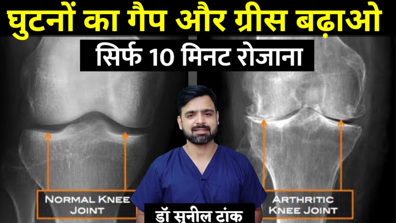 घुटनों में गैप | घुटनों के ग्रीस के लिए घरेलू व्यायाम | घुटने घिसने का इलाज | knee pain जड़ से खत्म