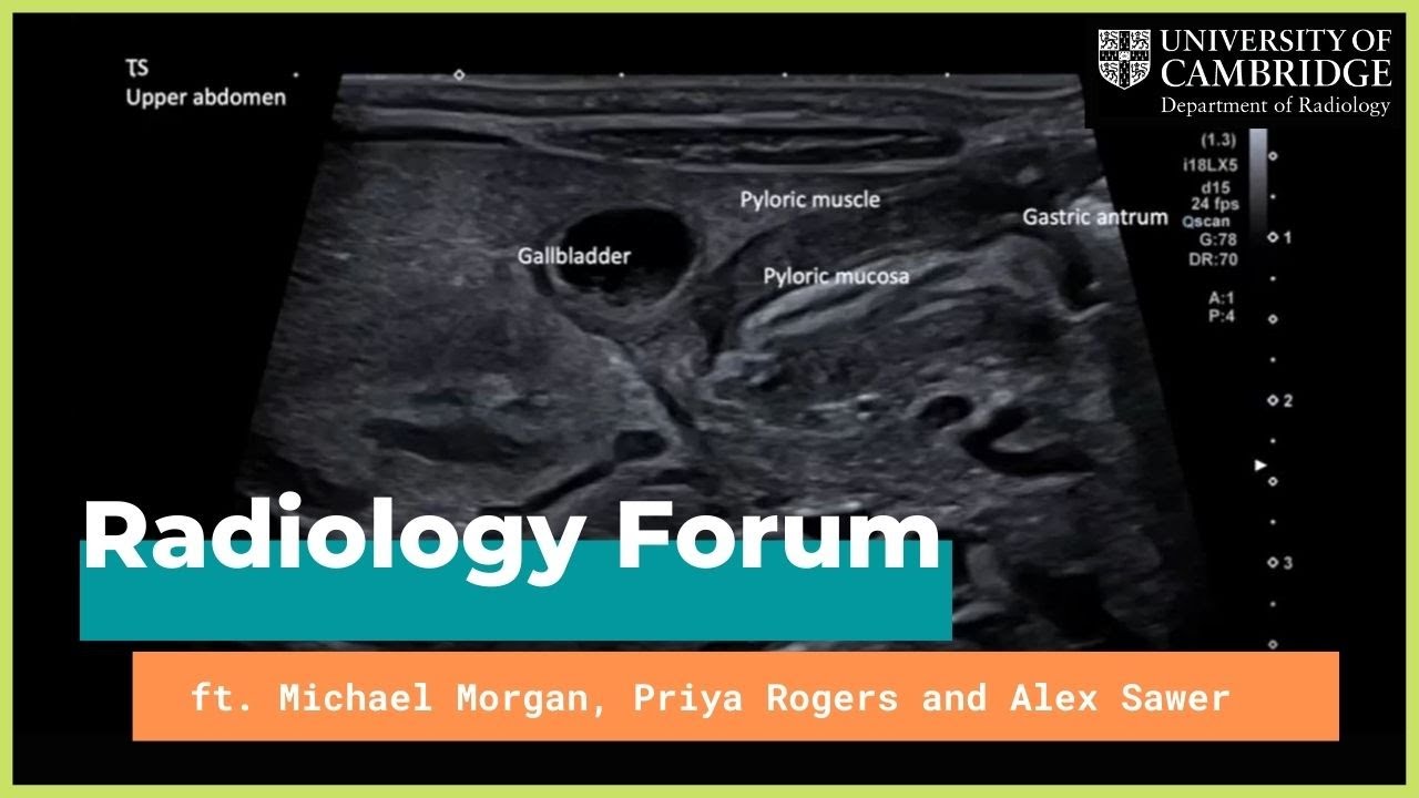 'Ultrasound in the Acute On-call Setting' by Dr Penny Moyle