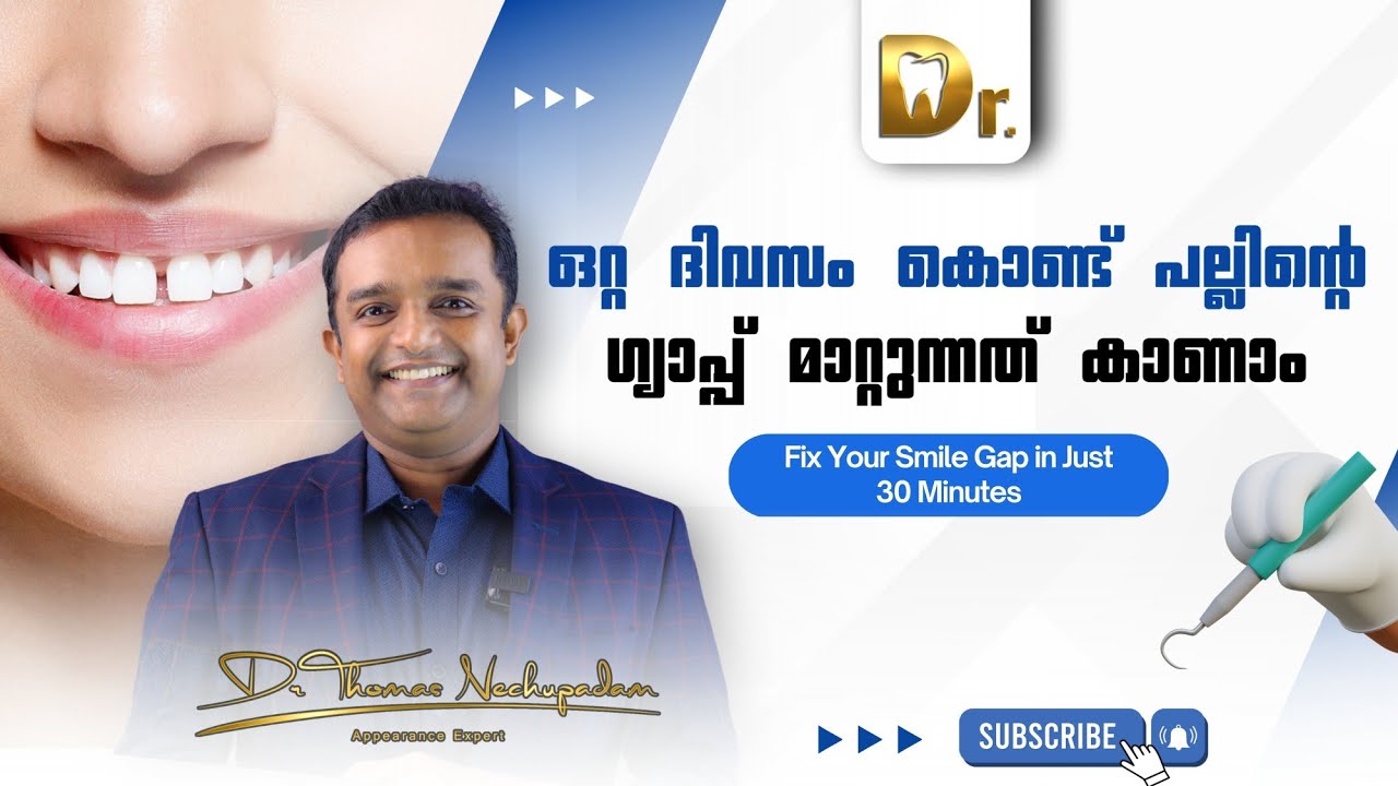 ഒറ്റ ദിവസം കൊണ്ട് പല്ലിന്റെ ഗ്യാപ്പ് മാറ്റുന്നത് കാണാം