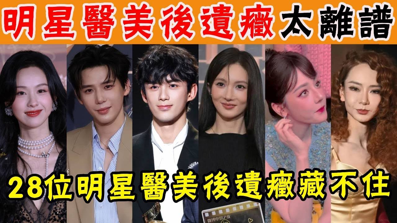 集體翻車！明星醫美後遺症藏不住！戚薇直呼太離譜，金晨又整容了，佟麗婭皮膚黝黑，陳都靈像酒店大堂經理#貴圈四姨太#週也#戚薇#迪麗熱巴#王一博#檀健次#陳都靈#蔡徐坤#吳磊#朱一龍#宋茜#宋佳#章子怡