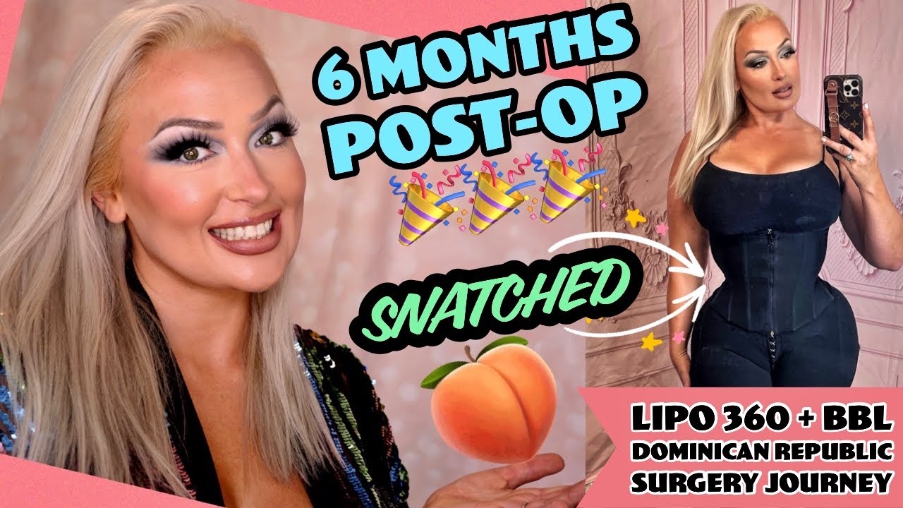 6 Months Post-Op Lipo 360 + BBL 🍑 Update + How I'm So SNATCHED // Dominican Republic // Dr Medina