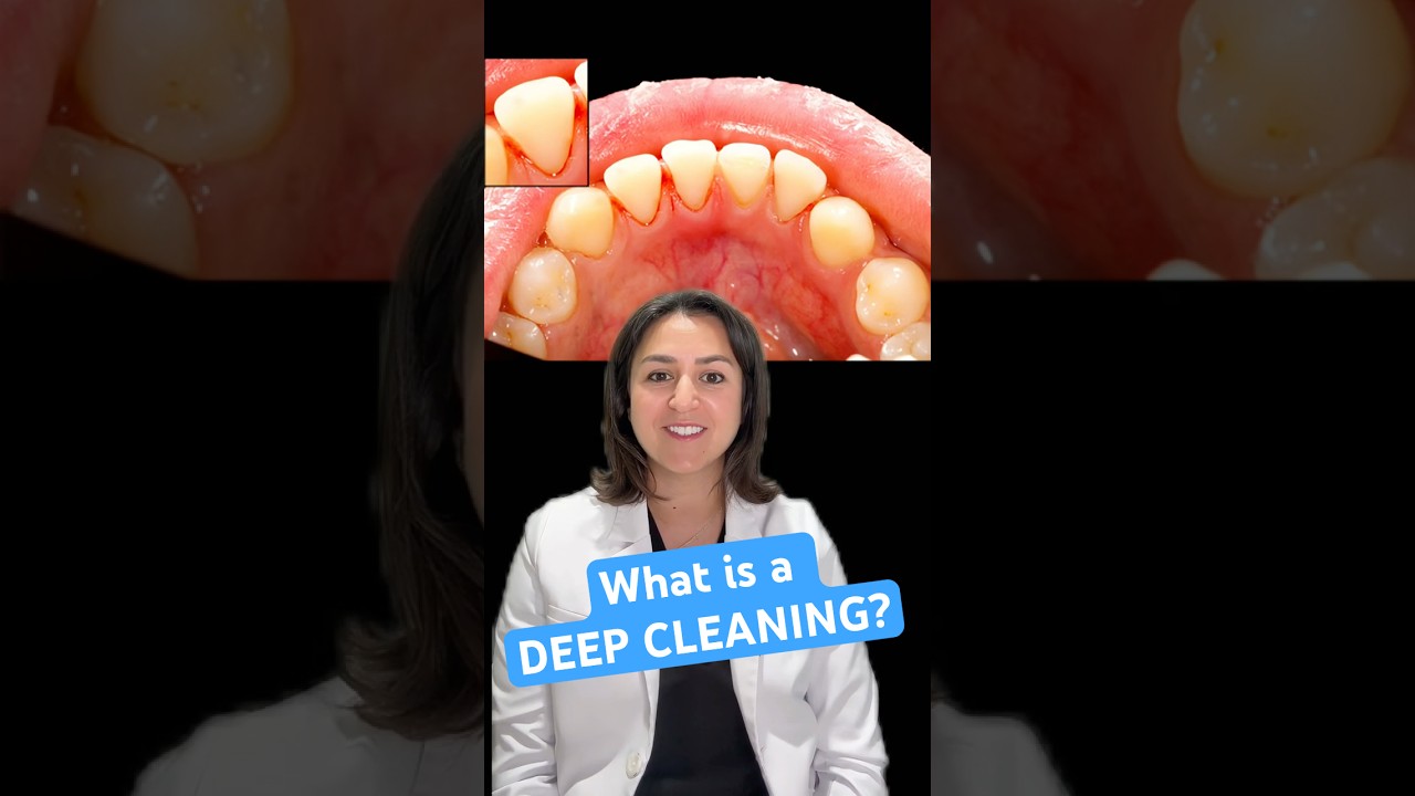 You&rsquo;ve Been Told You Need a Deep Cleaning&hellip;What Does That Mean?  |  District Dental Surgery