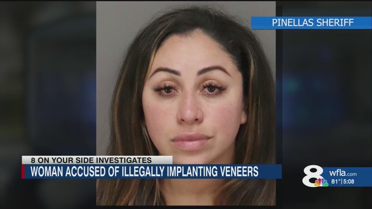 Fake Veneers with Nail Glue? Tampa Woman Accused of Illegal Dental Work