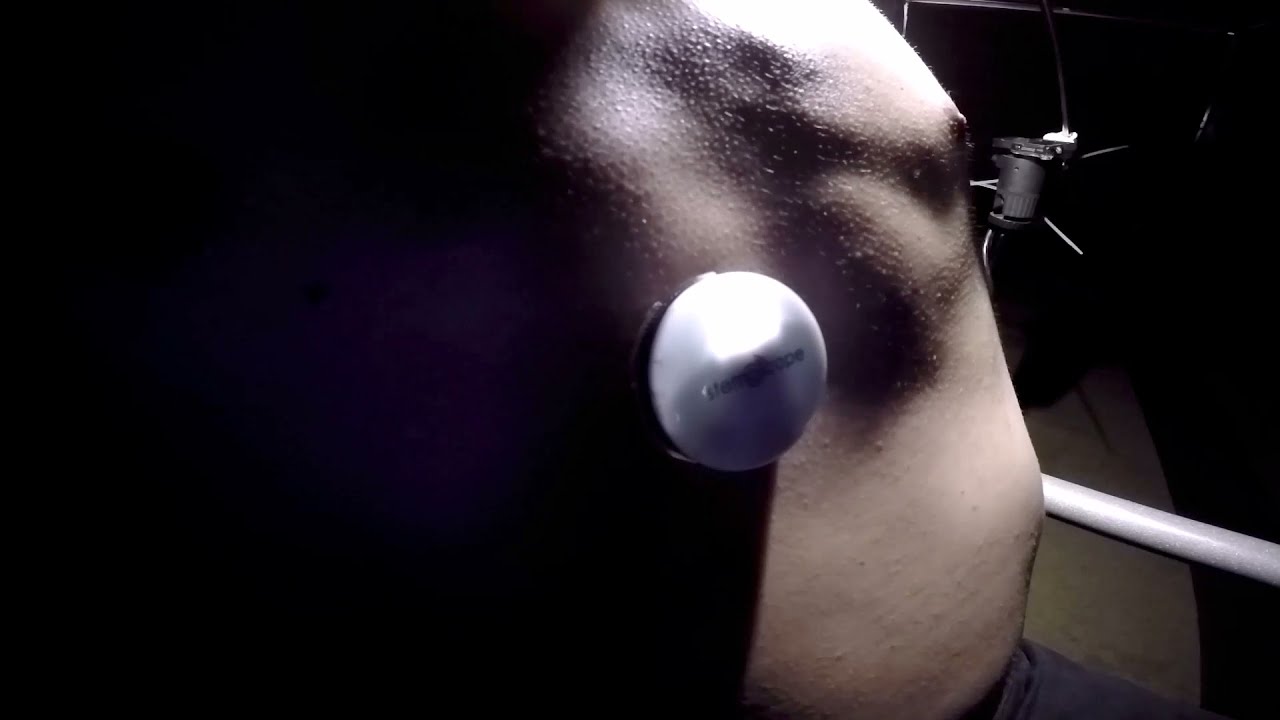Extremely visible irregular heartbeat