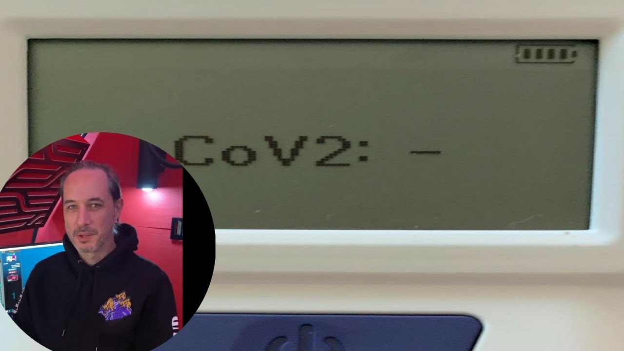 Joe Rogan Interviews His Producer Jamie About Getting Covid-19!!!