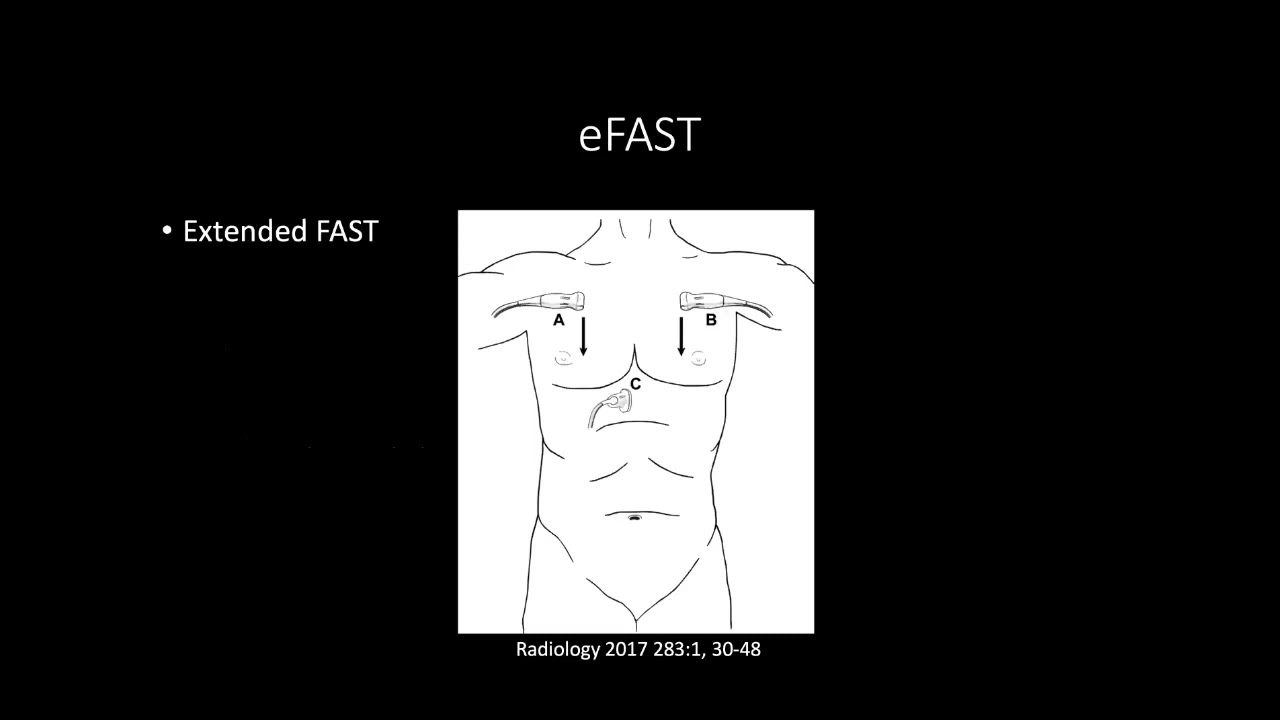 Generalidades Eco FAST   Ecografía Abdominal