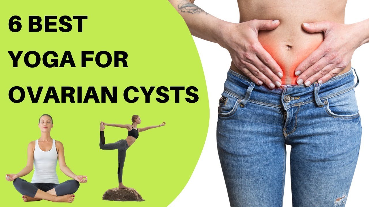 6 Best Yoga For Ovarian Cysts & Home Remedies | Ovarian cyst ka ayurvedic treatment in hindi