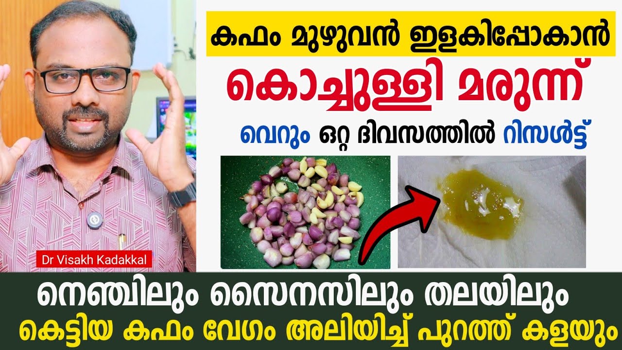 കൊച്ചുള്ളി മരുന്ന് ; കഫം ഇളകി പോകും | വെറും ഒറ്റ ദിവസത്തിൽ റിസൾട്ട്  | Kapham elaki pokaan 