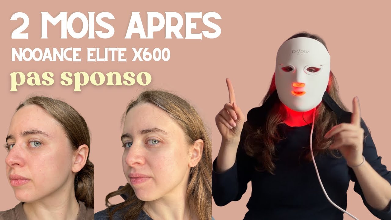 2 mois d’utilisation du masque Nooance - Mon avis et avant après 