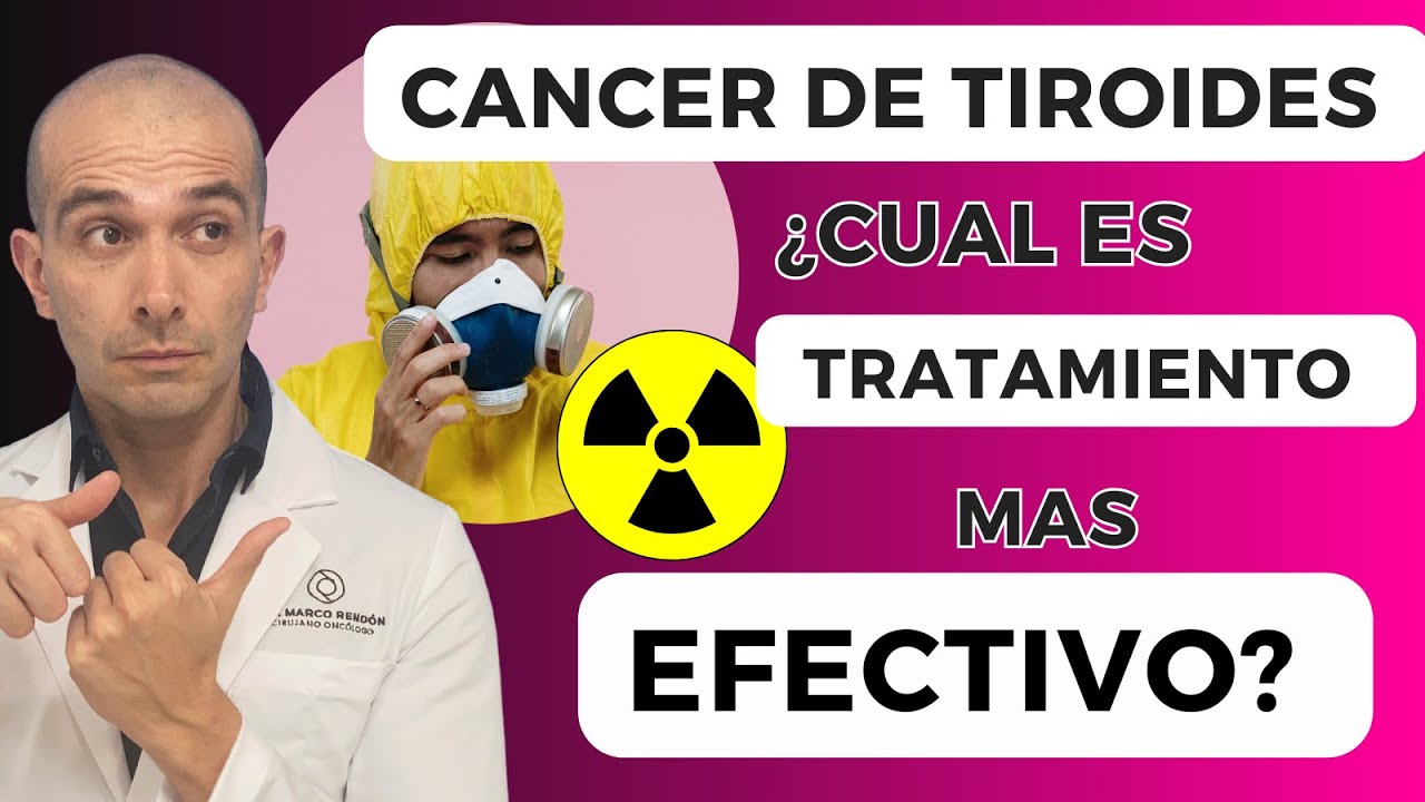 !Descubre el mejor tratamiento de cáncer de tiroides con yodo¡