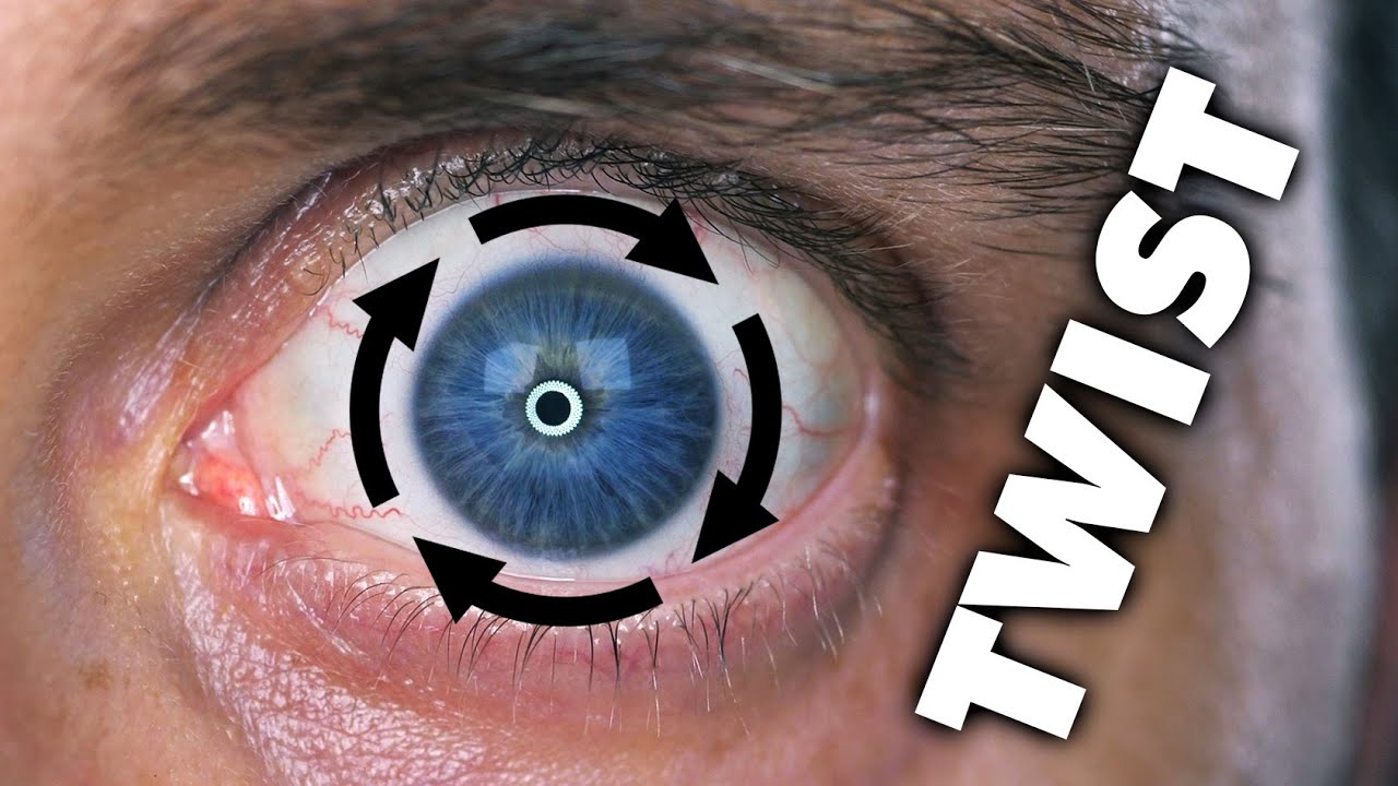 I Can Twist My Eye Around Its Pupil (And So Can You)