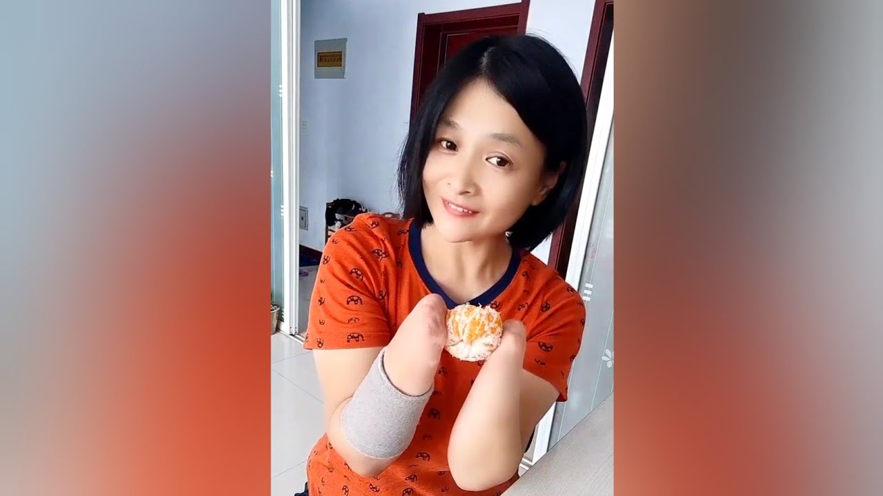 Amputee Girl Peeling and Eating Oranges | Wrist Amputation | Amputada