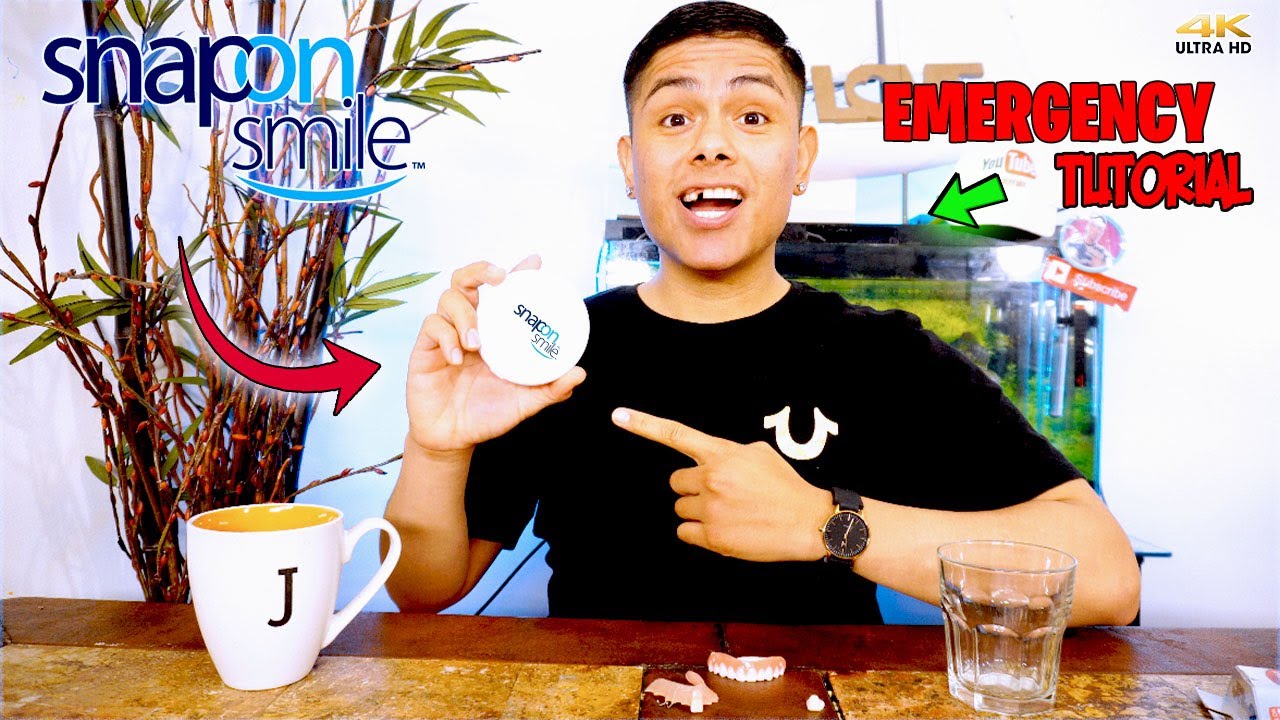 Руководство по установке виниров Snap On Smile | Сохраните свою улыбку! Это работает!