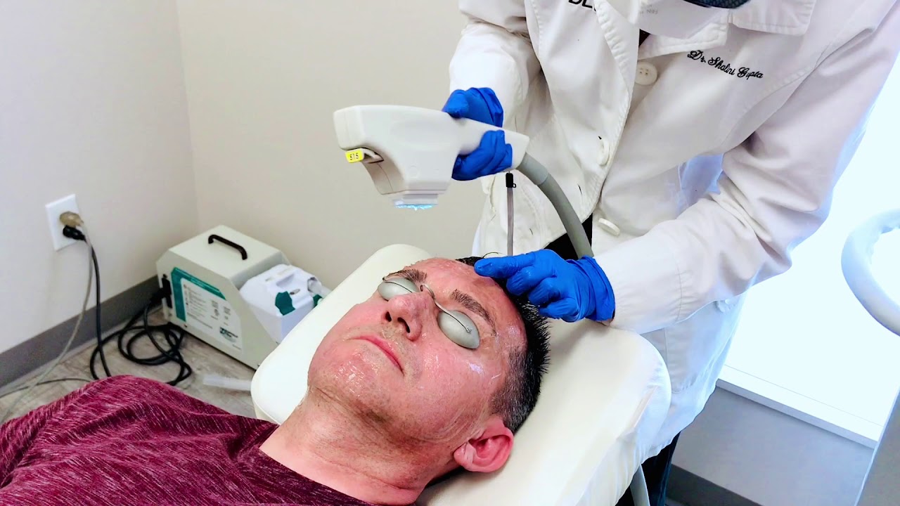 BBL Forever young laser treatment for Pigmentation on Skin