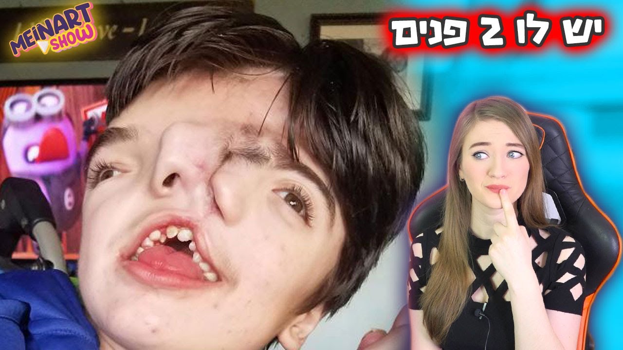 ככה הם נולדו!! (סיפור מטורף) אנשים הכי מוזרים בעולם