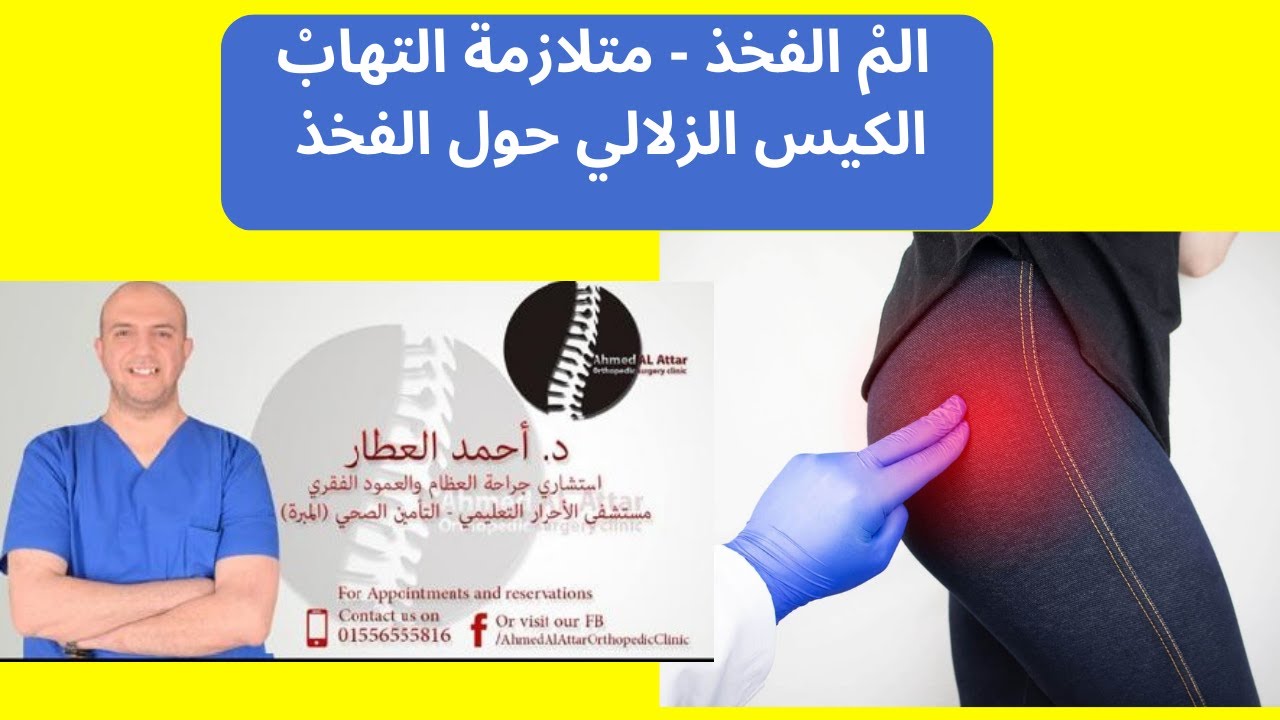 المْ الفخذ - متلازمة التهابْ الكيس الزلالي حول الفخذ