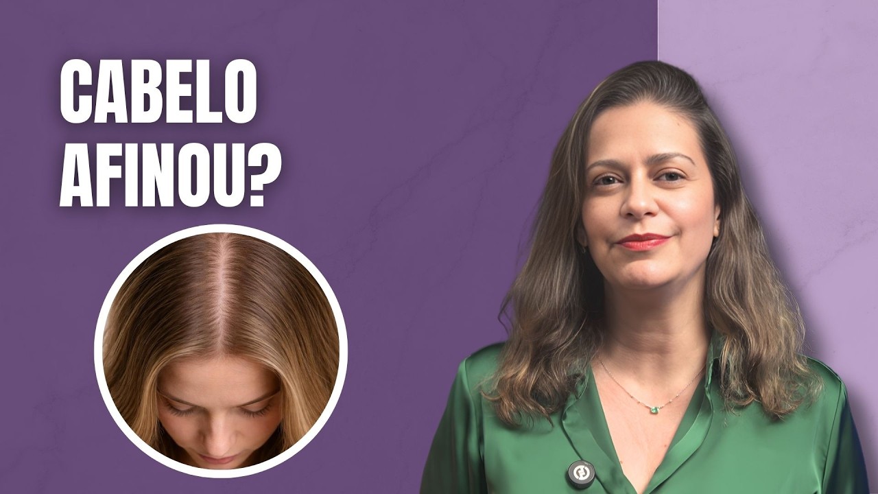 Calvície (alopecia androgenética) começa assim e quase ninguém percebe!